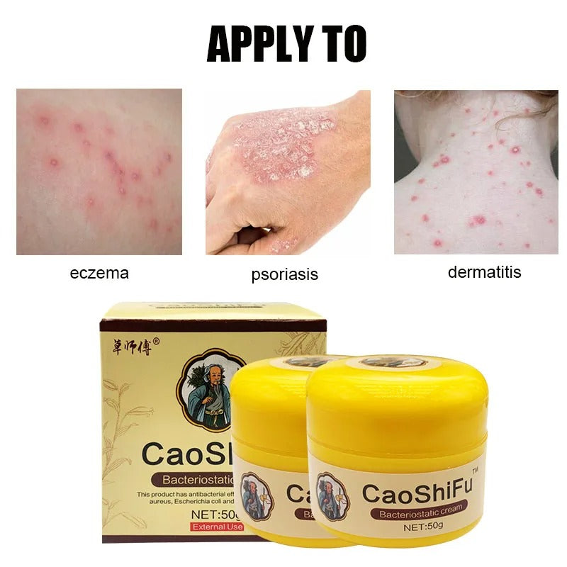 ZB Chinese Herbal Medicine Psoriasis Ointment Cooling Bacteriostatic Treatment Dermatitis Eczema Antibacterial Medical Plaster